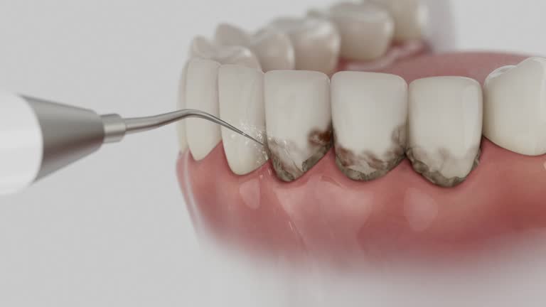 Reliable Dental contractor in Breckenridge, MN by Dentist Open Now